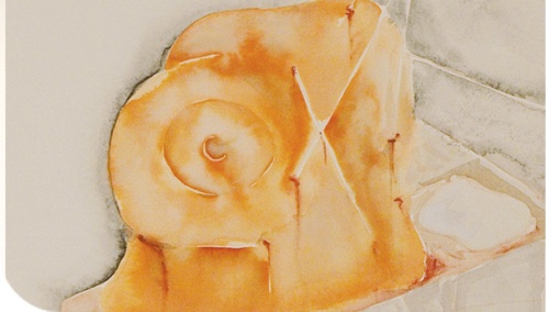 SIGNORA HINKLE, LEI PER CASO E� PAZZA?